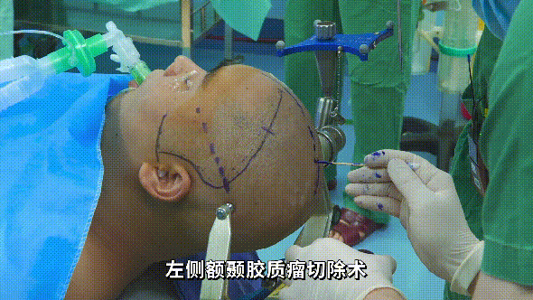 17.gif