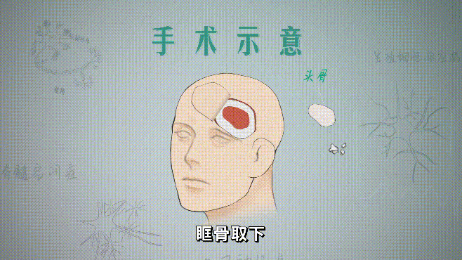 06.gif