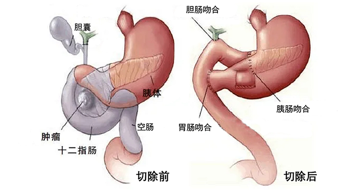 腹腔镜镜结构示意图图片