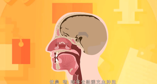10.gif